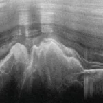 Antarctica's Gamburtsev Mountains covered by ice, discovered using sound waves in 1958.